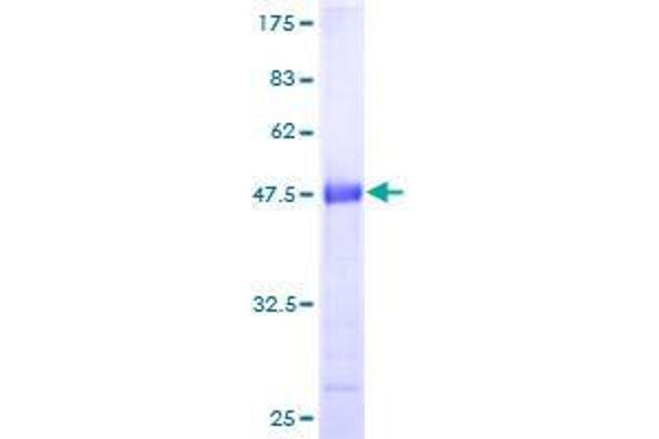 GCET2 Protein (AA 1-178) (GST tag)