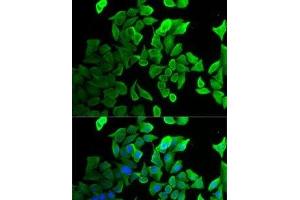 Immunofluorescence analysis of U2OS cells using SEPT2 Polyclonal Antibody (Septin 2 Antikörper)