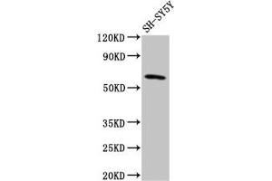 Western Blot Positive WB detected in: SH-SY5Y whole cell lysate All lanes: DEAF1 antibody at 3. (DEAF1 Antikörper  (AA 73-200))