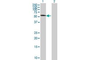 Western Blot analysis of KRT8 expression in transfected 293T cell line by KRT8 MaxPab polyclonal antibody. (KRT8 Antikörper  (AA 1-483))