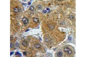 Used in DAB staining on fromalin fixed paraffin-embedded Liver tissue (Fibrinogen beta Chain Antikörper  (AA 29-118))