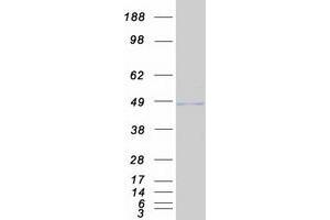 Western Blotting (WB) image for serine/threonine/tyrosine Kinase 1 (STYK1) protein (Myc-DYKDDDDK Tag) (ABIN2732917)