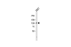 Western Blotting (WB) image for anti-G Protein-Coupled Receptor Kinase Interactor 2 (GIT2) (AA 714-749), (C-Term) antibody (ABIN6243209)