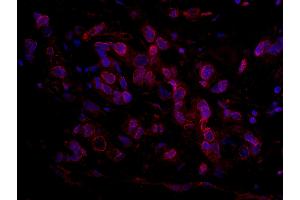 Immunofluorescence (IF) image for anti-RBP1-like protein (ARID4B) (AA 125-175) antibody (ABIN7448931)