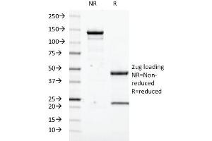 SDS-PAGE Analysis Purified Transglutaminase II Mouse Monoclonal Antibody (SPM358). (Transglutaminase 2 Antikörper)