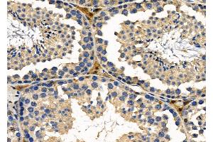 ABIN6257439 and ABIN6276207 at 1/100 staining Mouse testis tissue by IHC-P. (PRLHR Antikörper  (Internal Region))