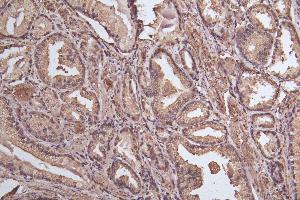 Immunohistochemistry of paraffin-embedded human thyroid tissue using ABIN7164566 at dilution of 1:100 (ZDHHC12 Antikörper  (AA 121-197))