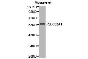 Western Blotting (WB) image for anti-Solute Carrier Family 32 (GABA Vesicular Transporter), Member 1 (SLC32A1) antibody (ABIN1874828) (SLC32A1 Antikörper)