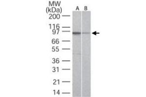 Western blot analysis of TLR5 in A) Ramos and B) Raw cell lysate using TLR5 monoclonal antibody, clone 19D759. (TLR5 Antikörper  (AA 700-800))