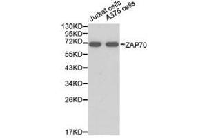 Western Blotting (WB) image for anti-zeta-Chain (TCR) Associated Protein Kinase 70kDa (ZAP70) antibody (ABIN1875382) (ZAP70 Antikörper)