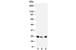 Western blot testing of DUSP3 antibody and Lane 1:  rat testis (Dual Specificity Phosphatase 3 (DUSP3) (C-Term) Antikörper)