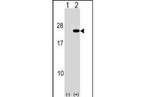 Western blot analysis of IP2 (arrow) using rabbit polyclonal IP2 Antibody (N-term) (ABIN1539498 and ABIN2848464). (PAIP2 Antikörper  (N-Term))