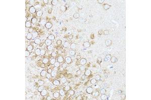 Immunohistochemistry (Paraffin-embedded Sections) (IHC (p)) image for anti-Arrestin, beta 1 (ARRB1) (AA 169-418) antibody (ABIN3021265)
