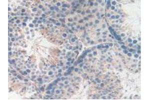 Figure. (LAMP2 Antikörper  (AA 295-410))