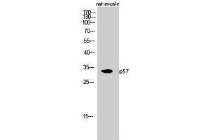 Western Blotting (WB) image for anti-P57 (N-Term) antibody (ABIN3176739) (P57 (N-Term) Antikörper)