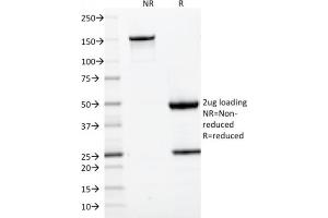 SDS-PAGE (SDS) image for anti-CD22 Molecule (CD22) (AA 52-178) antibody (ABIN6941120)