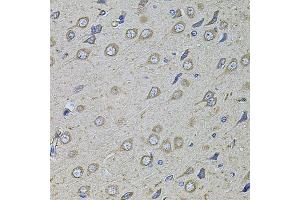 Immunohistochemistry of paraffin-embedded rat brain using COL1A2 antibody. (COL1A2 Antikörper)