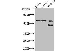 Western Blot Positive WB detected in: Hela whole cell lysate, Mouse liver tissue, Mouse kidney tissue All lanes: EHD2 antibody at 3 μg/mL Secondary Goat polyclonal to rabbit IgG at 1/50000 dilution Predicted band size: 62, 47 kDa Observed band size: 62, 47 kDa