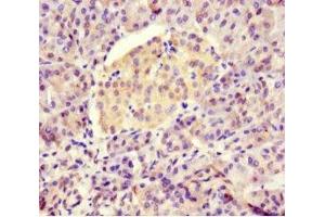 Immunohistochemistry of paraffin-embedded human pancreatic tissue using ABIN7145898 at dilution of 1:100 (BTNL2 Antikörper  (AA 26-202))