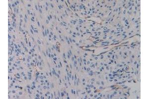 Detection of ITGb3 in Mouse Uterus Tissue using Polyclonal Antibody to Integrin Beta 3 (ITGb3) (Integrin beta 3 Antikörper  (AA 134-376))