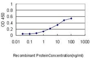 Detection limit for recombinant GST tagged RIPK4 is approximately 0. (RIPK4 Antikörper  (AA 675-784))