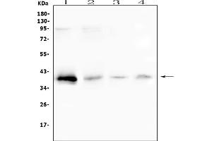 Western blot analysis of RP2 using anti-RP2 antibody (ABIN6719513). (RP2 Antikörper  (AA 244-348))