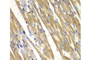 Immunohistochemistry of paraffin-embedded Rat heart using TYR Polyclonal Antibody at dilution of 1:100 (40x lens). (TYR Antikörper)
