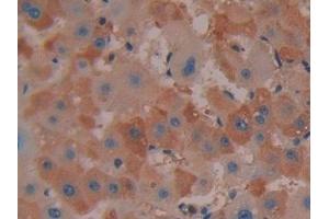 Detection of COX 2 in Human Liver Tissue using Polyclonal Antibody to Cyclooxygenase-2 (COX 2) (COX2 Antikörper  (AA 187-425))