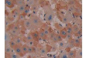 Detection of COX 2 in Human Liver Tissue using Polyclonal Antibody to Cyclooxygenase-2 (COX 2) (PTGS2 Antikörper  (AA 187-425))