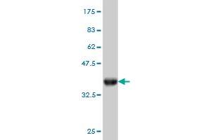 Western Blot detection against Immunogen (36. (RBBP9 Antikörper  (AA 87-185))