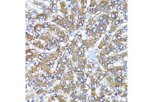Immunohistochemistry of paraffin-embedded rat liver using  antibody (ABIN7265709) at dilution of 1:100 (40x lens). (ATG3 Antikörper)