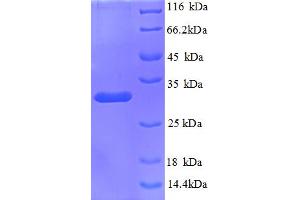 SDS-PAGE (SDS) image for Kininogen 1 (KNG1) (AA 390-644) protein (His tag) (ABIN5712930)