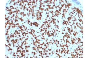 Immunohistochemistry (IHC) image for anti-NK3 Homeobox 1 (NKX3-1) (AA 92-224) antibody (ABIN6940209)