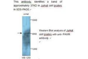 Image no. 1 for anti-PRKC, Apoptosis, WT1, Regulator (PAWR) antibody (ABIN790827) (PAWR Antikörper)