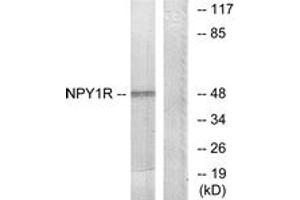 Western blot analysis of extracts from NIH-3T3 cells, using NPY1R Antibody. (NPY1R Antikörper  (AA 221-270))