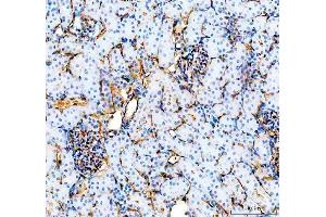 IHC analysis of CD31/Pecam1 using anti-CD31/Pecam1 antibody (ABIN7601662). (CD31 Antikörper  (AA 41-258))