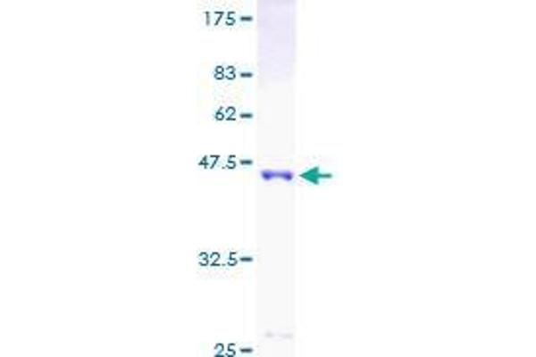 IL1RN Protein (AA 1-159) (GST tag)