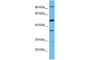 Host:  Rabbit  Target Name:  SUN1  Sample Tissue:  Human HCT116 Whole Cell  Antibody Dilution:  1ug/ml (SUN1 Antikörper  (N-Term))