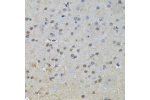 Immunohistochemistry of paraffin-embedded mouse brain using NRF1 Antibody (ABIN6290682) at dilution of 1:100 (40x lens). (NRF1 Antikörper)
