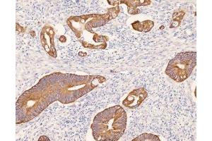 Immunohistochemistry (IHC) image for anti-Keratin 8 (KRT8) (C-Term) antibody (ABIN870547) (KRT8 Antikörper  (C-Term))