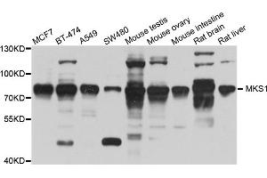 Western blot analysis of extracts of various cell lines, using MKS1 antibody (ABIN5995499) at 1/1000 dilution. (MKS1 Antikörper)