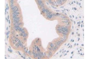 IHC-P analysis of Mouse Uterus Tissue, with DAB staining. (GDF5 Antikörper  (AA 358-495))