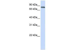ACP6 antibody used at 1 ug/ml to detect target protein. (ACP6 Antikörper  (N-Term))