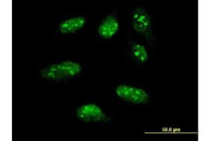 Immunofluorescence of monoclonal antibody to LHX1 on HeLa cell. (LHX1 Antikörper  (AA 1-100))