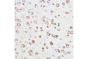 Immunohistochemistry of paraffin-embedded rat brain using NOMO1 Rabbit pAb (ABIN6128346, ABIN6144710, ABIN6144711 and ABIN6214793) at dilution of 1:350 (40x lens). (NOMO1 Antikörper  (AA 700-1000))