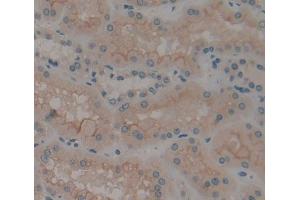 IHC-P analysis of Kidney tissue, with DAB staining. (CAMLG Antikörper  (AA 19-184))