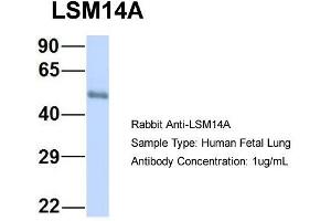 Host: Rabbit  Target Name: LSM14A  Sample Tissue: Human Fetal Lung  Antibody Dilution: 1.
