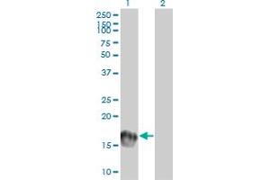 Western Blot analysis of UBE2C expression in transfected 293T cell line by UBE2C monoclonal antibody (M01), clone 9D3.