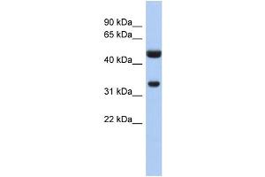 WB Suggested Anti-SULT1B1 Antibody Titration:  0. (SULT1B1 Antikörper  (N-Term))