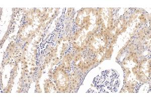 Detection of PTHR2 in Human Kidney Tissue using Monoclonal Antibody to Parathyroid Hormone Receptor 2 (PTHR2) (PTH2R Antikörper  (AA 27-145))
